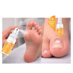 SET – mykóza nôh (kompletná domáca starostlivosť) – Obrázok 2