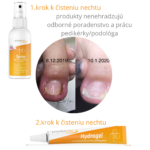 SET – zarastený necht (domáca starostlivosť) – Obrázok 2