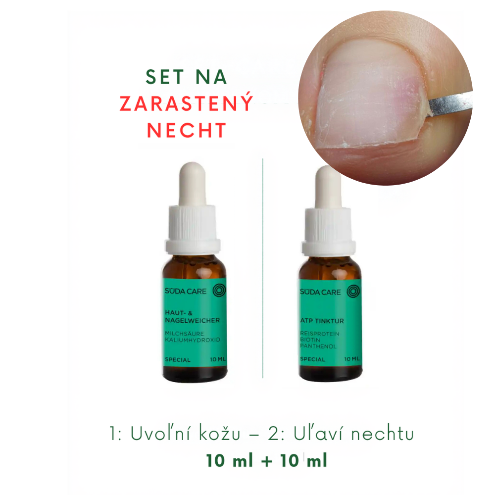 SÜDA CARE set na zarastený necht – zmäkčovač pokožky a nechtov a ATP tinktúra Set na zarastený necht – zmäkčenie a upokojenie (10 ml + 10 ml) – Obrázok 1